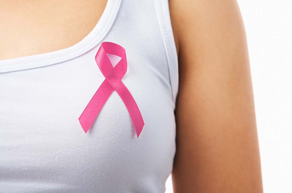 Breast Cancer